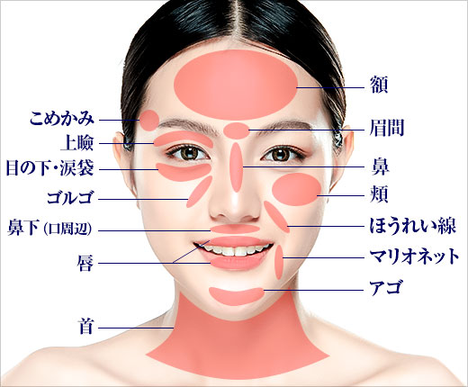 顔のヒアルロン酸の注入部位